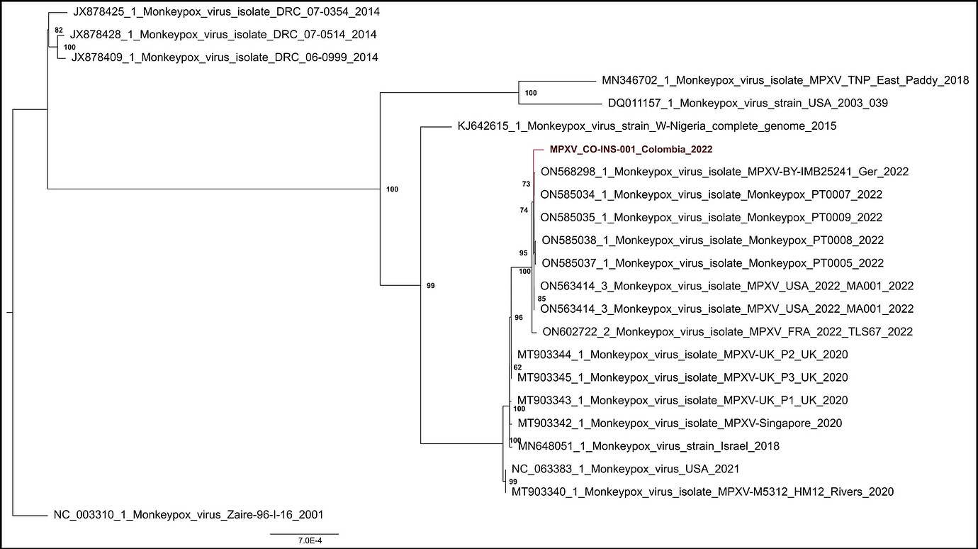 Monkeypox virus genome sequence from an imported case in Colombia ...
